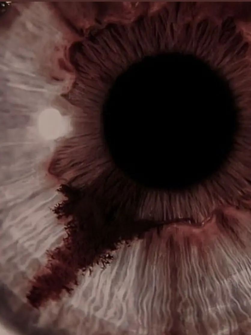 FolksyCumin0199의 Bleeding Supernova