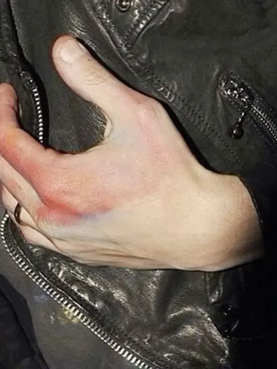 cherris의 𑣿 02 | 𝓢plits and bruises.
