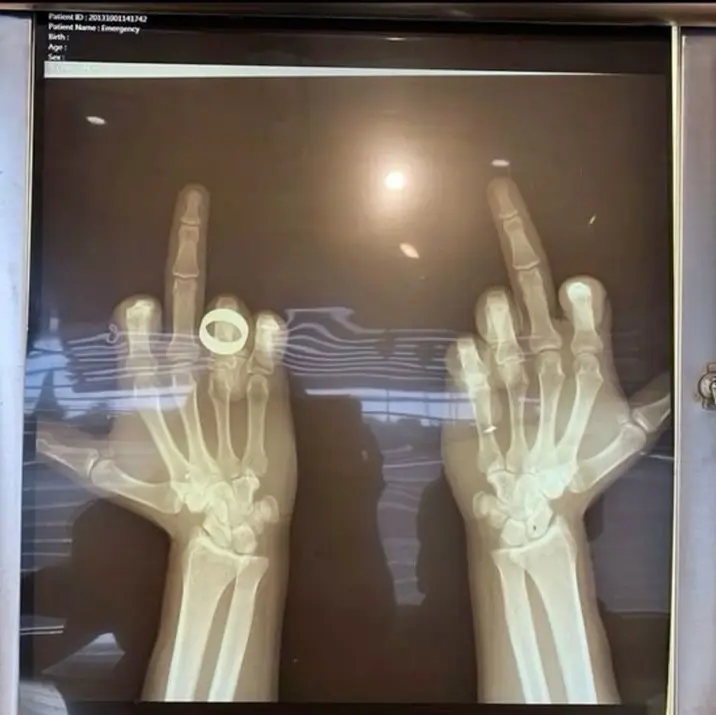 GreenPet9464의 닥터 스트레인지