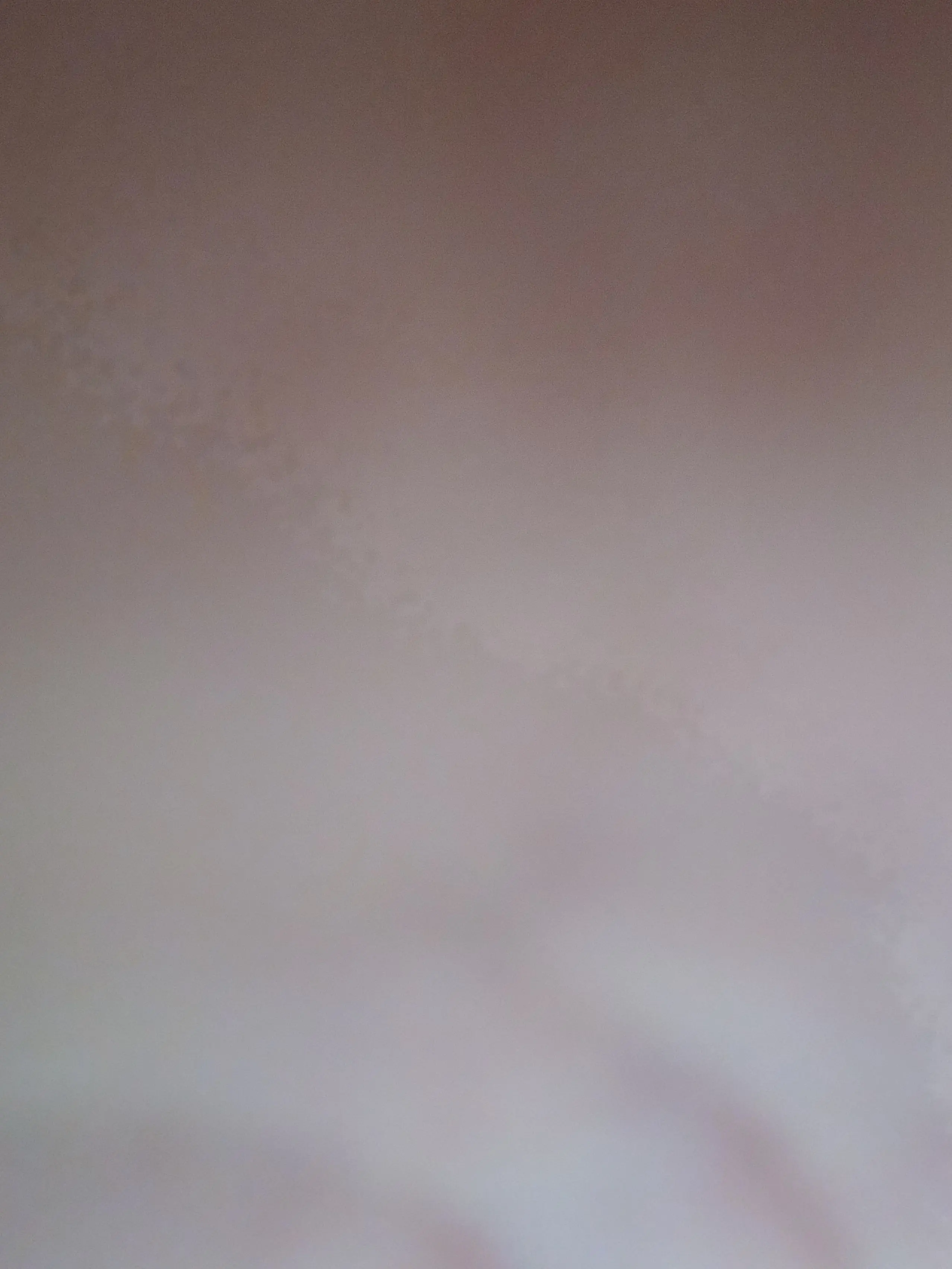 Rollal의 소꿉친구 고탁