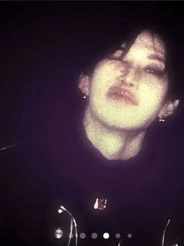 Changbinleftbutcheak_hairy의 Bangchan