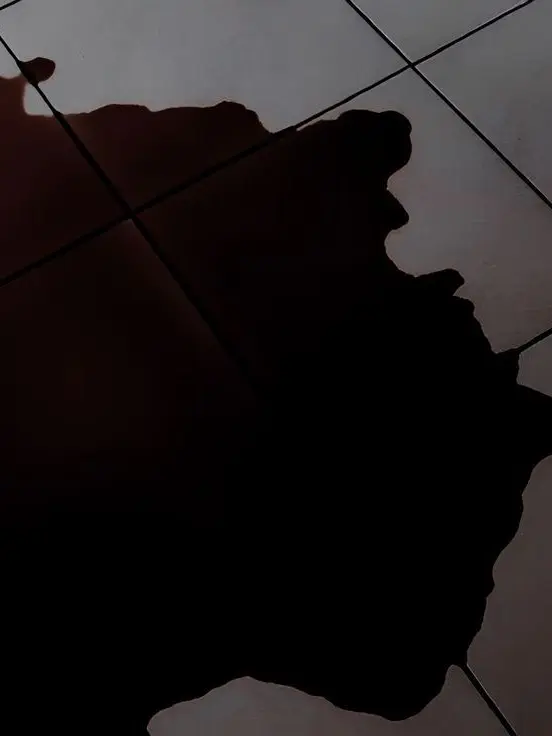 bk.0420의 흡혈