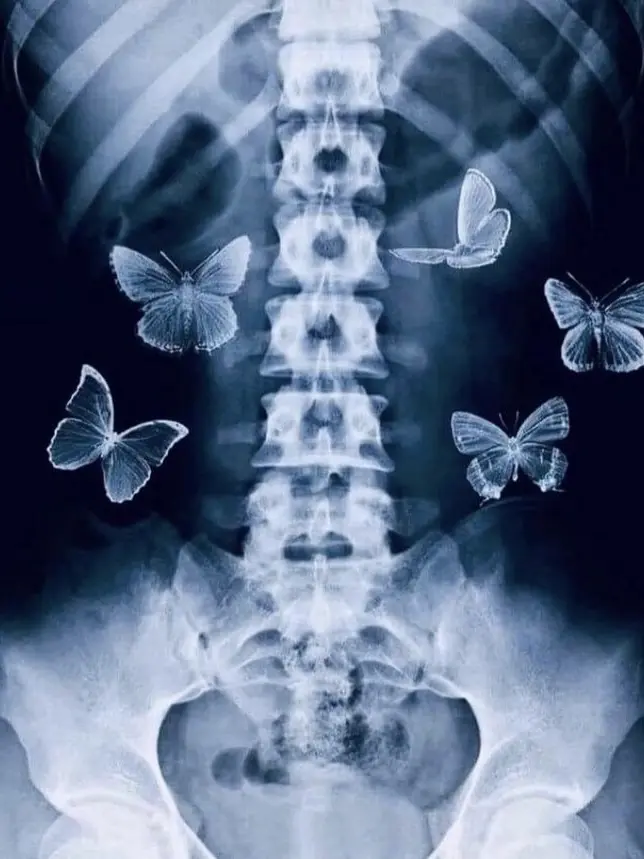 Para-dise의 잔향쵸우 ちょう