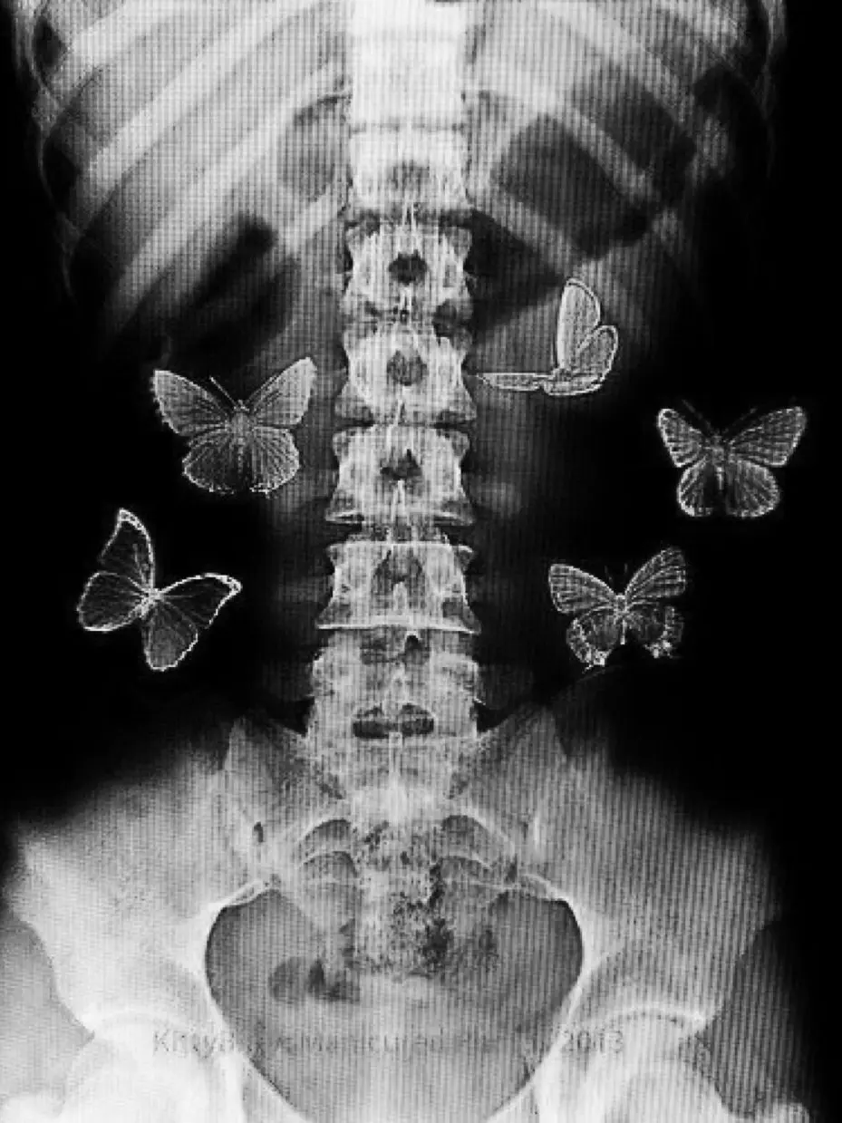 g00ng_3ack의 国崩