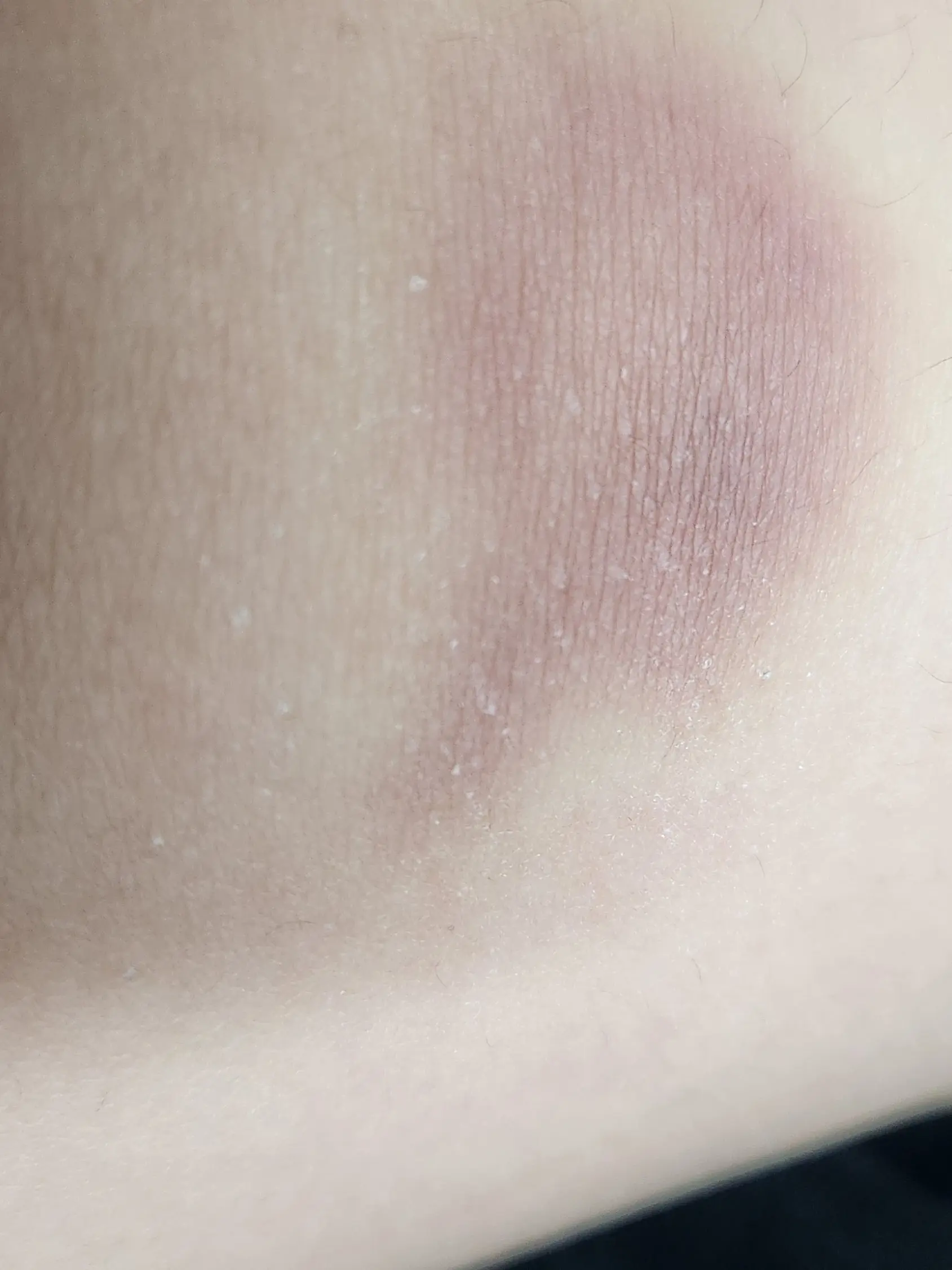 QWERQQWWEERR의 미수반이 여우에게 속은날