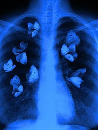 Para_dise의 쵸우하키 병