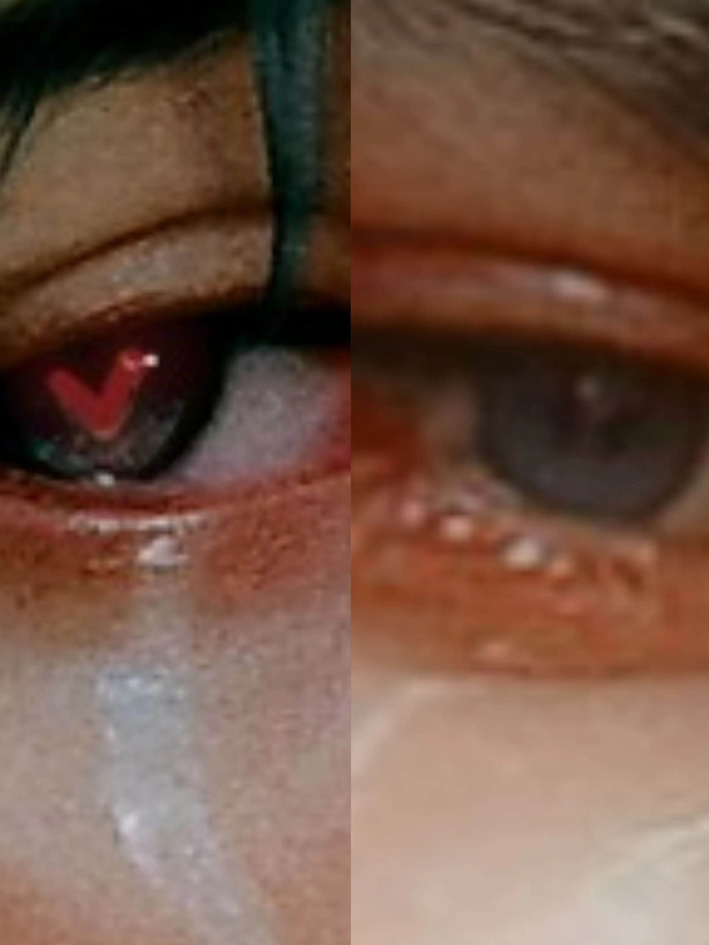 ace11의 어질어질 학교생활