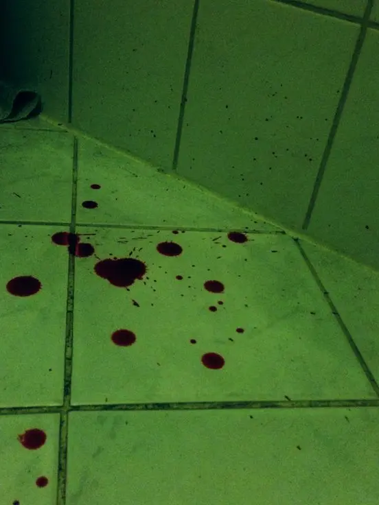 Imnotblyat의 설태운