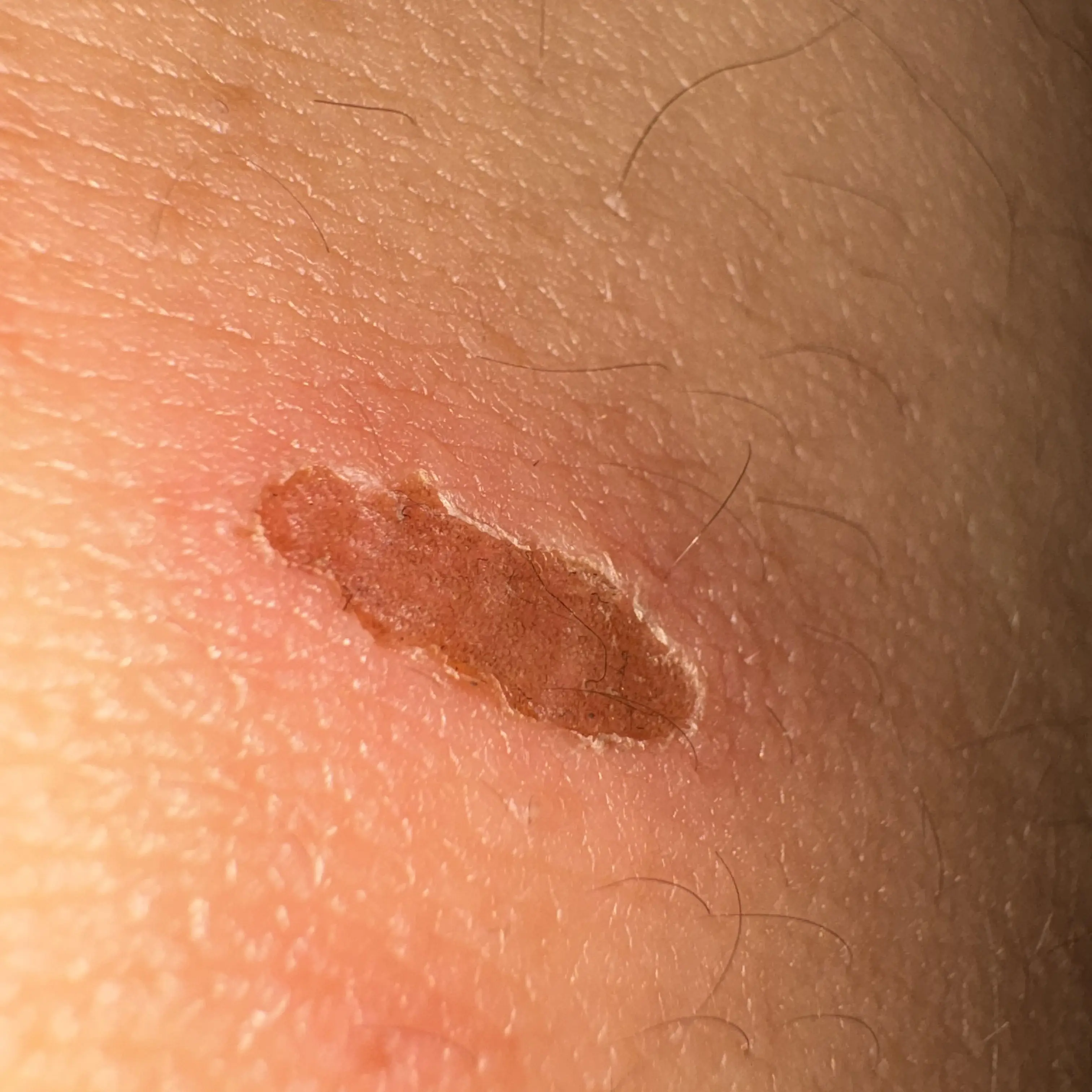 CroakyDaug5138의 금쪽이같은 내새끼