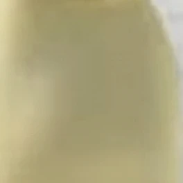 급똥