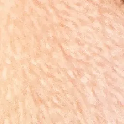 aikane의 譲