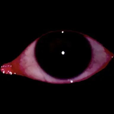 Profile image of 스코폴리오시스