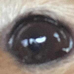 친구1
