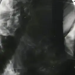 BrightAlbum5488의 大森元貴