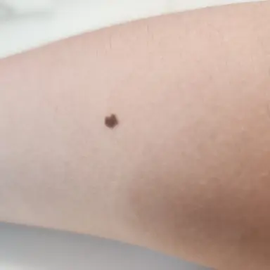 Profile image of 천연두