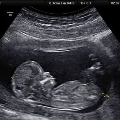 Profile image of The Creature