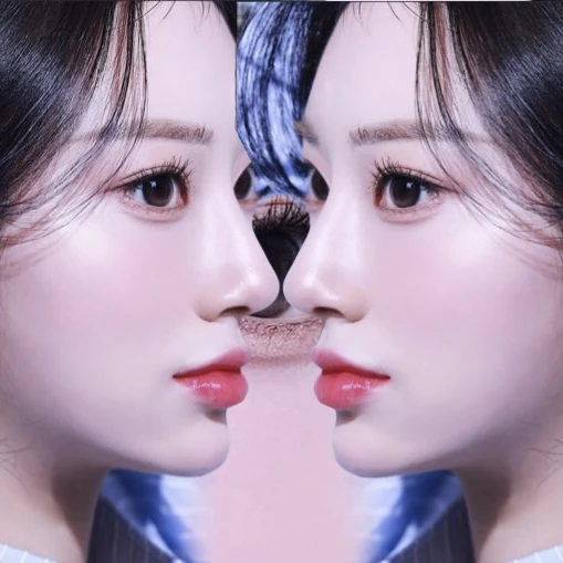 여자레즈비언커플 엄신비,김지영