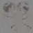 宮侑と宮治