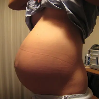 Profile image of あなたは妊娠した