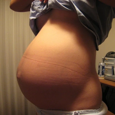 あなたは妊娠した