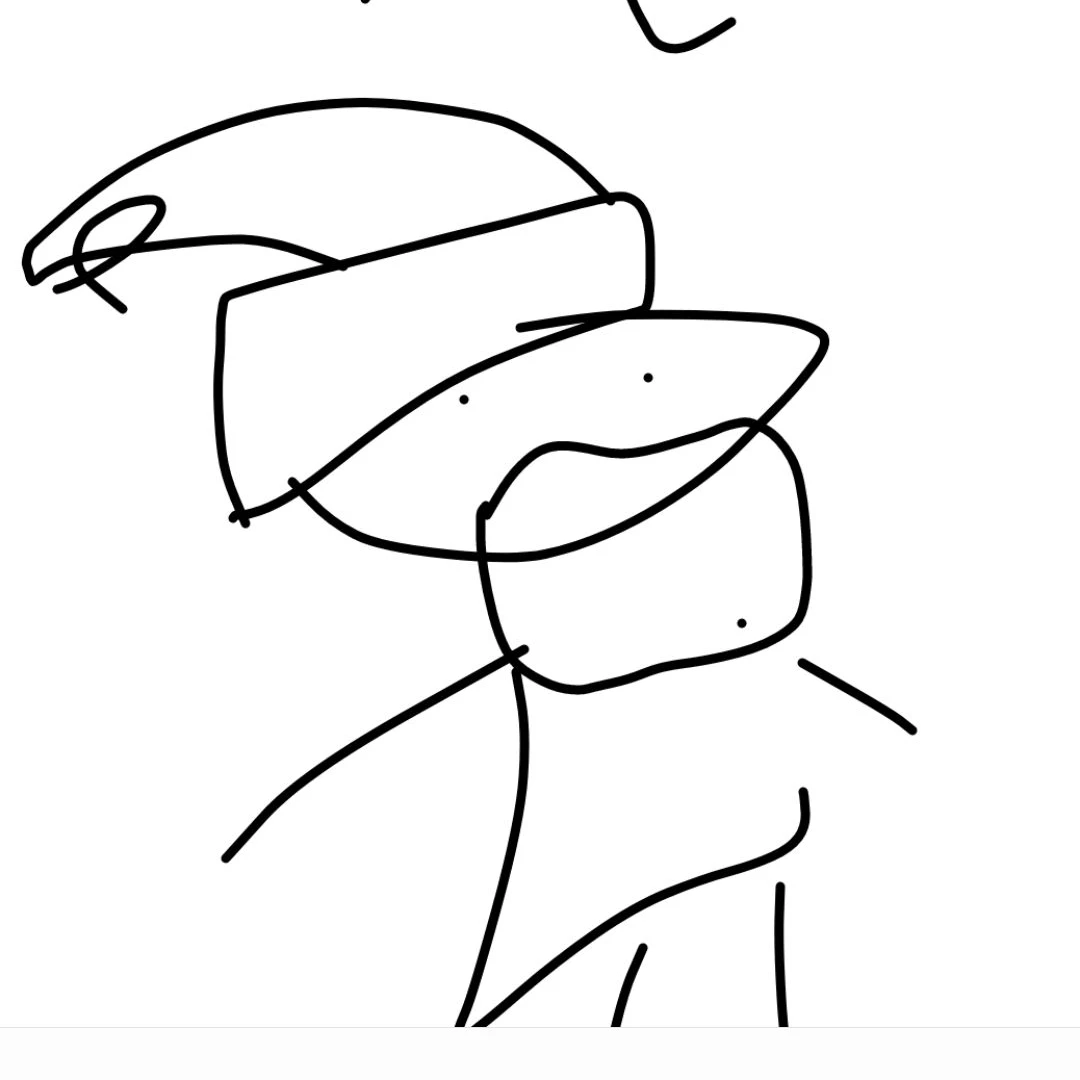 산타 탈모