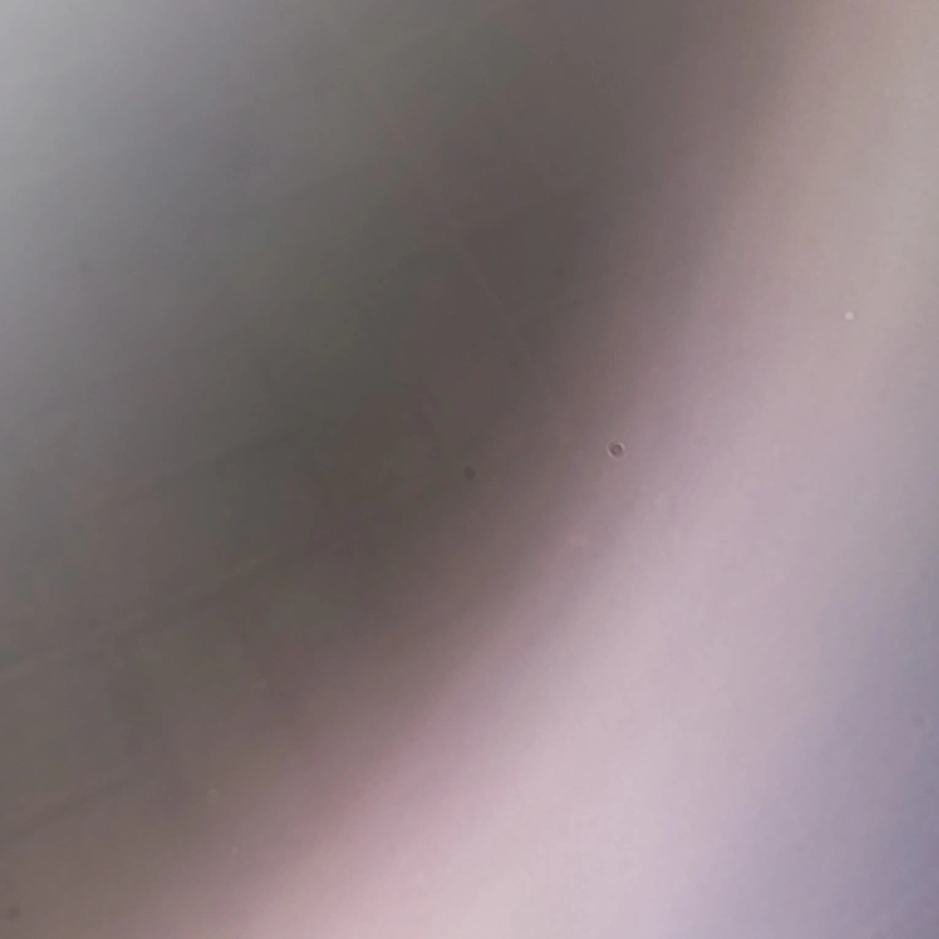 FeebleDiver4641의 각별🌟