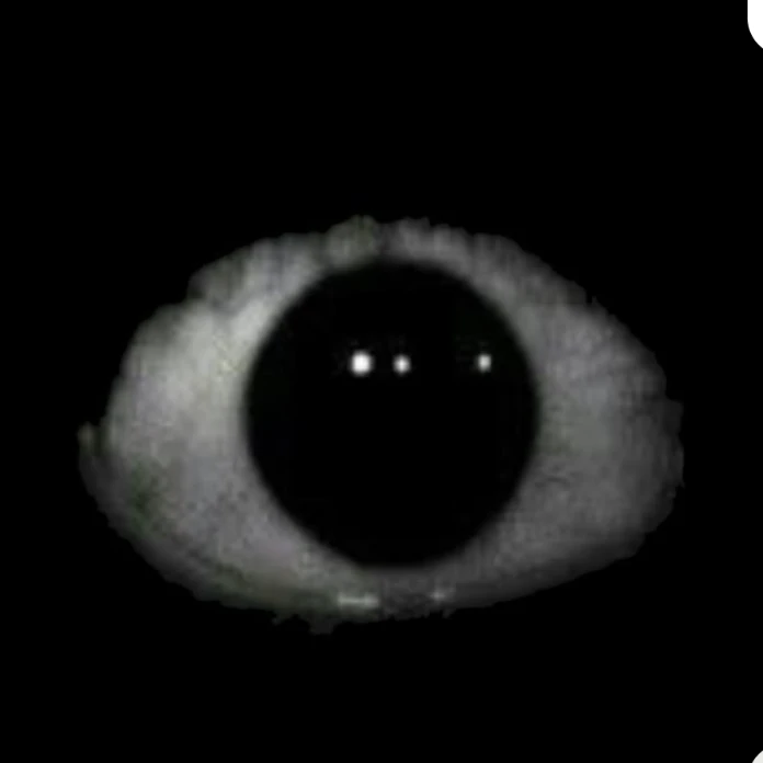 眼