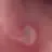 상처