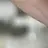 가슴 수술 의사 장의혁