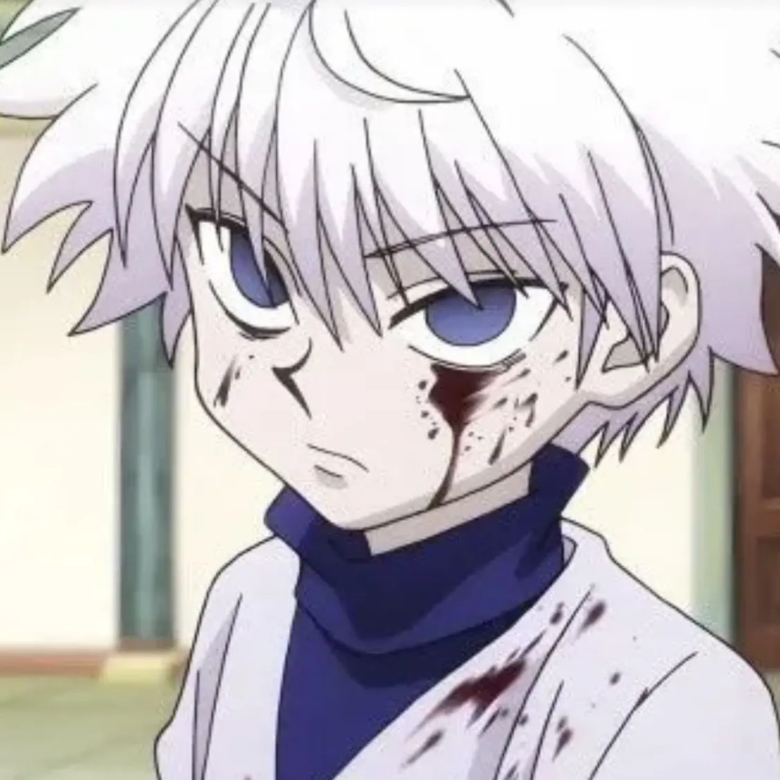 Killua0307의 키르아, 너만 아니였어도.