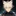재발
