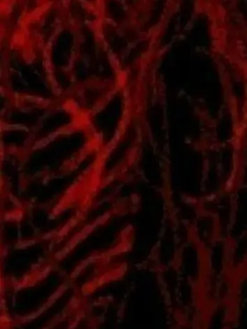 KiIl의 necro