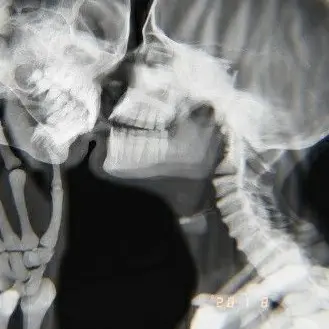 151_167의 silent cry