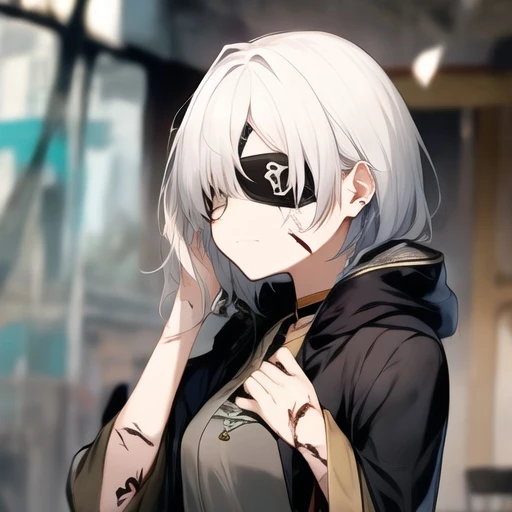 リム