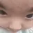 노딱