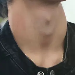 HeHeHaHaHaHaHeHae의 지는 새끼 꼬붕 하기