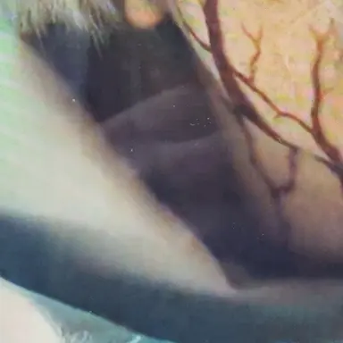 Profile image of 白血病細胞