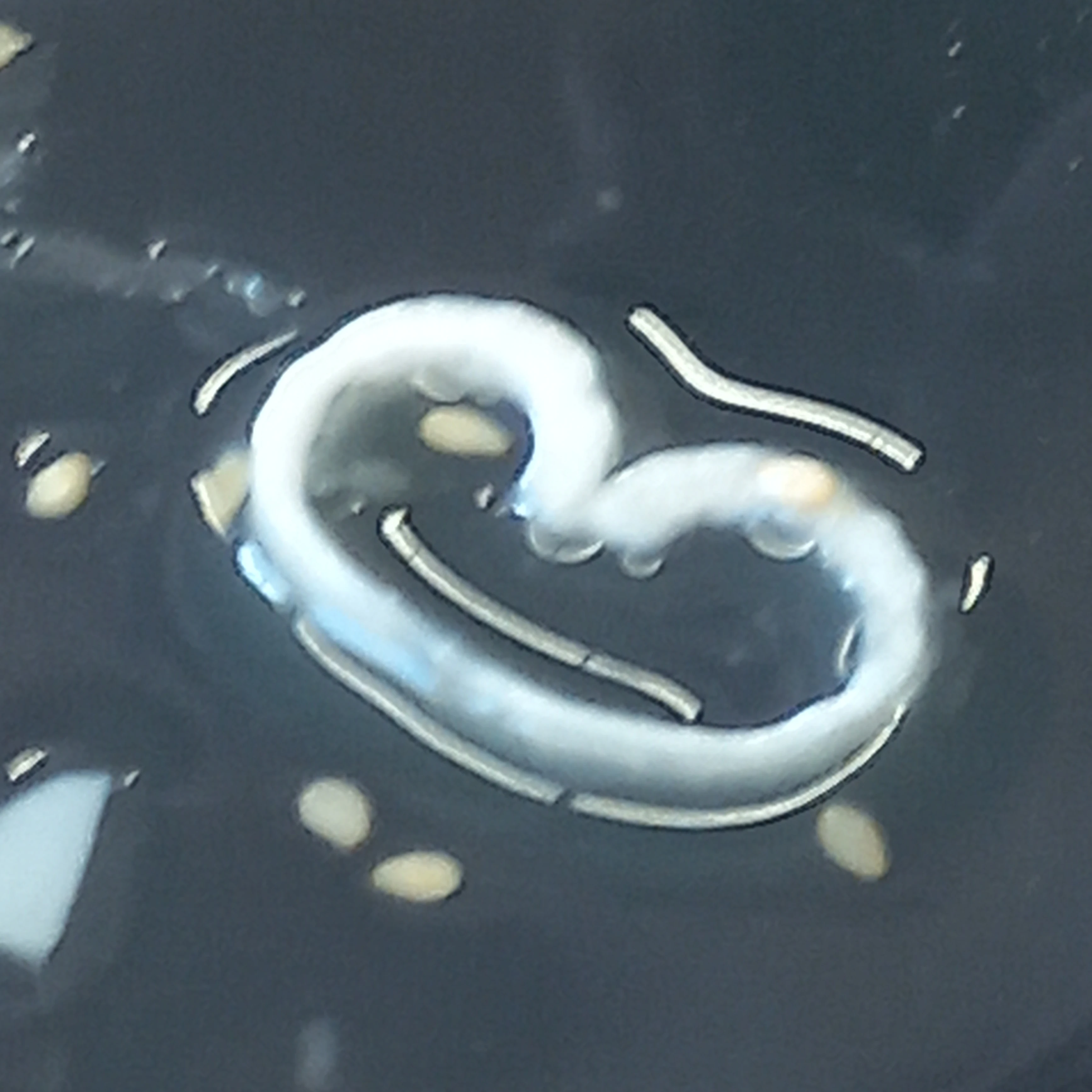 삶