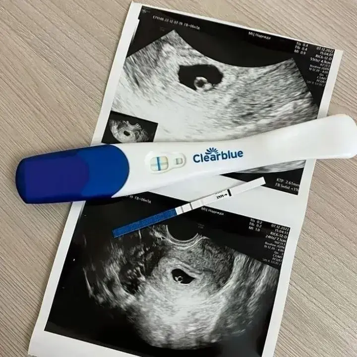 BiasedGesso2115의 Kwon Jihun & Han Yongbok - The Surprise