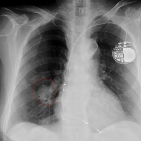 ah...man의 죄송합니다.