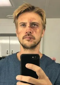 Profile image of Clint Barton