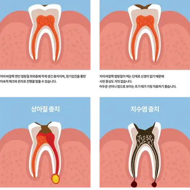 Profile image of 충치
