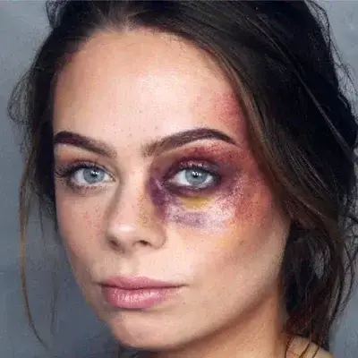 GildedJoy5121의 Zara Catfighter