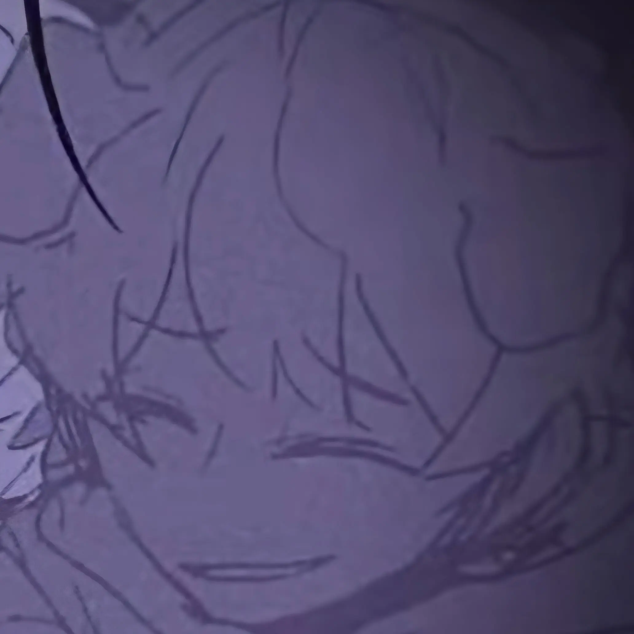 FrayedBilby9093의 덕개에게 납치를 당했다!?!?!