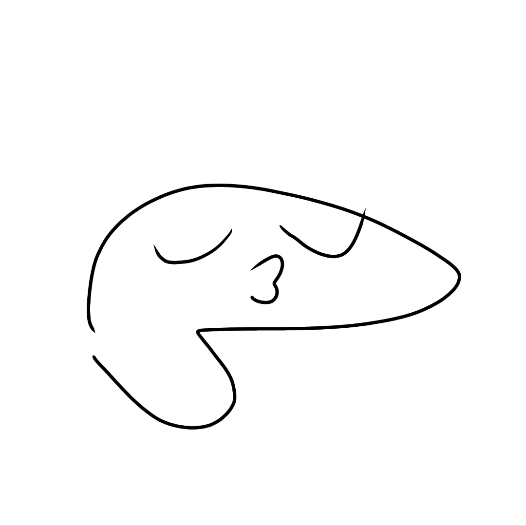 췌장