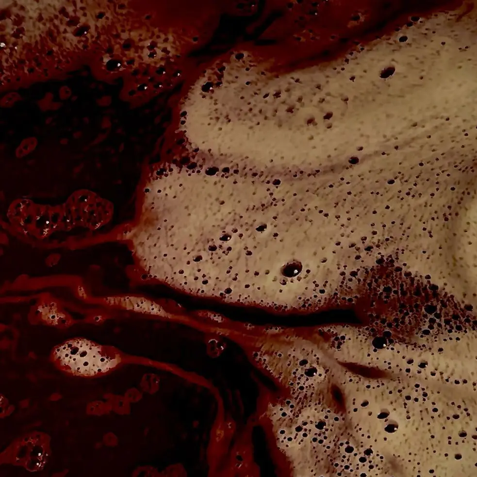 escapism_의 Clinical vampirism