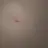 ㅇ