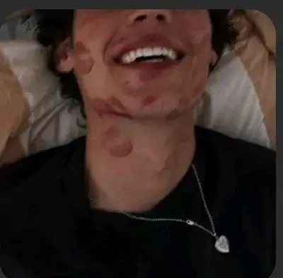 FluffyHawk0942의 Ethan