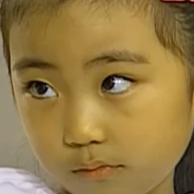 미달이