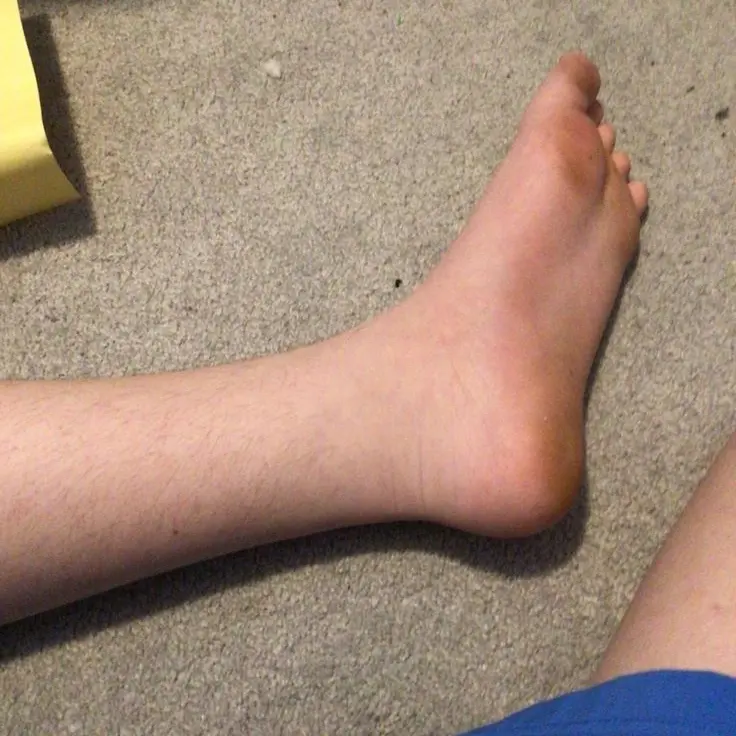 Ilaria의 Boy feet